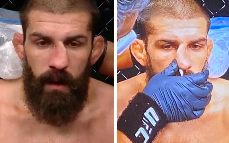 Court McGee bị đánh lệch mũi khi thượng đài tại UFC