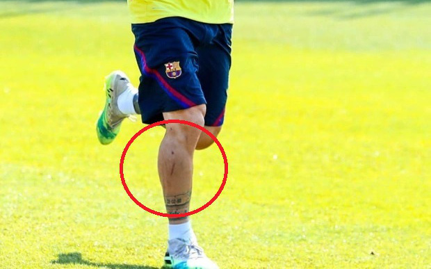 Fan xót xa nhìn Messi luyện tập với vết xước dài cả chục cm trên ống đồng