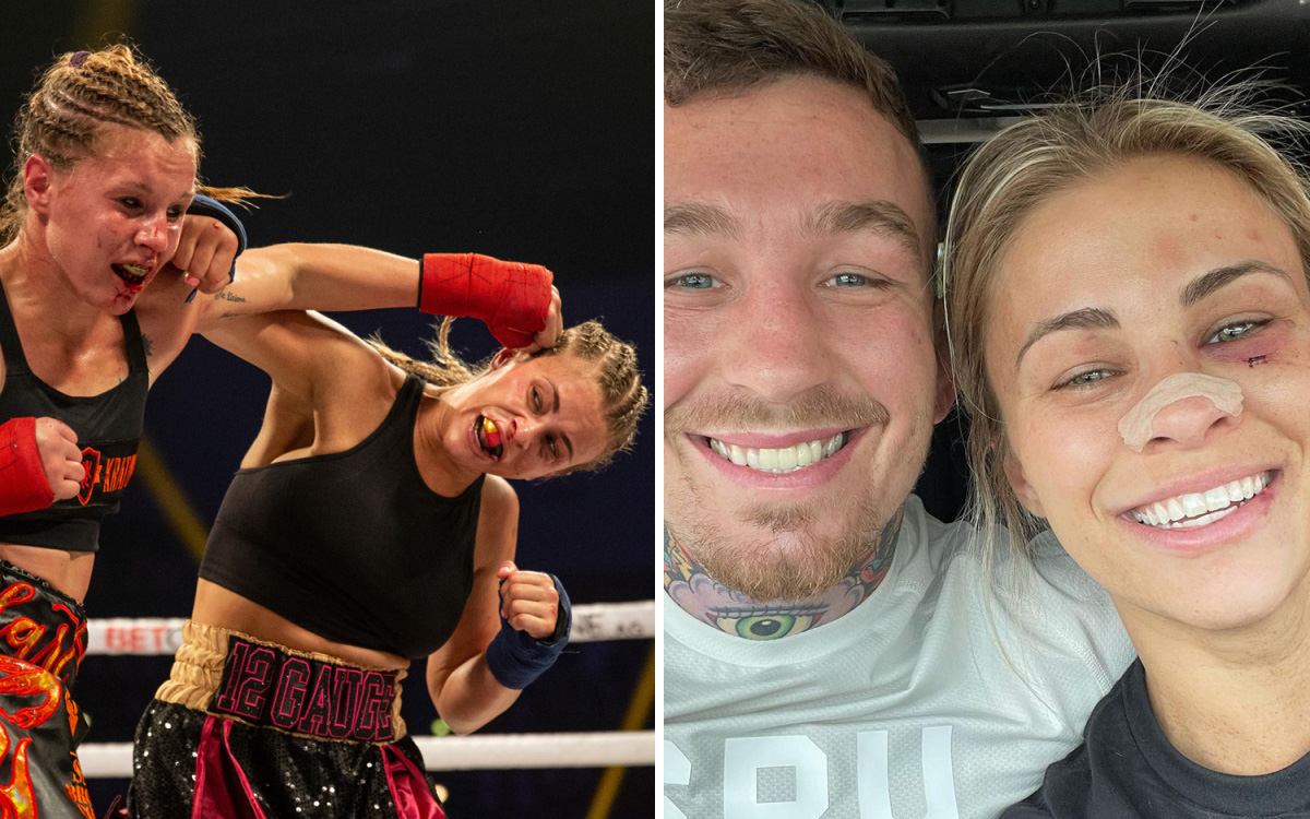 Mỹ nhân Paige VanZant khoe diện mạo nhiều thương tích sau ngày ra mắt làng boxing tay trần, khẳng định sẽ không giải nghệ