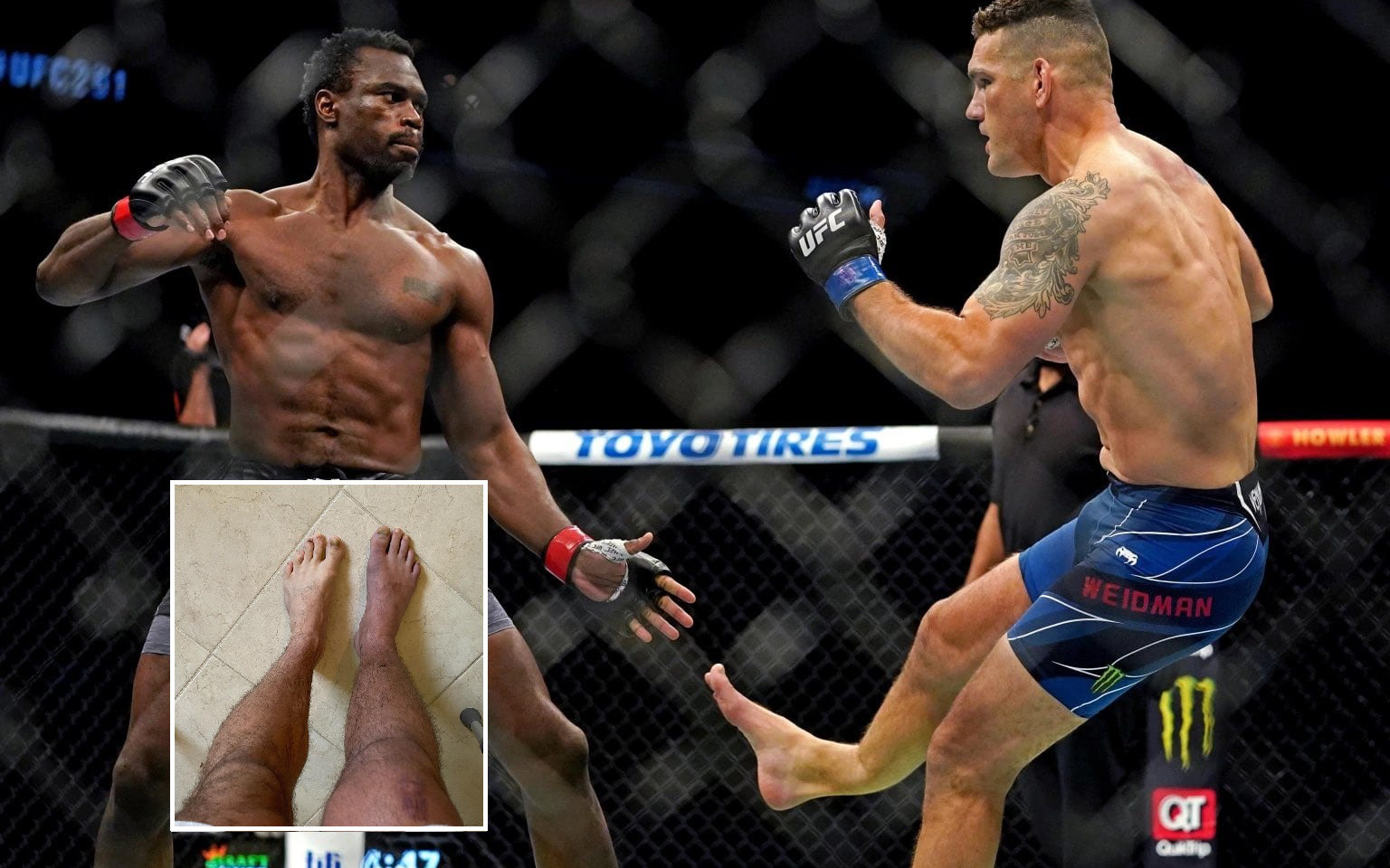 Cựu vương Chris Weidman cập nhật tình hình sau 3 tuần bị gãy chân: Nó đang có màu khác so với bên còn lại