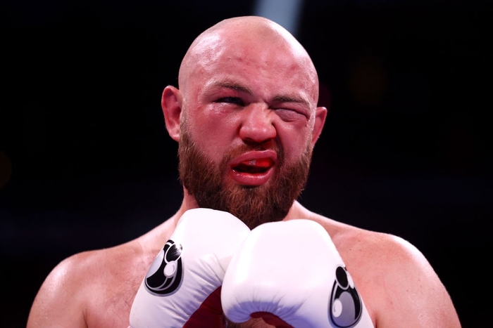 Ứng viên hạng nặng Adam Kownacki không được xì mũi sau khi bị đấm nứt sọ trong sự kiện Fury vs Wilder 3 - Ảnh 1.