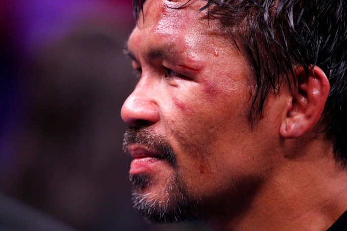 Manny Pacquiao phải khâu 8 mũi sau trận thua trước Yordenis Ugas - Ảnh 1.